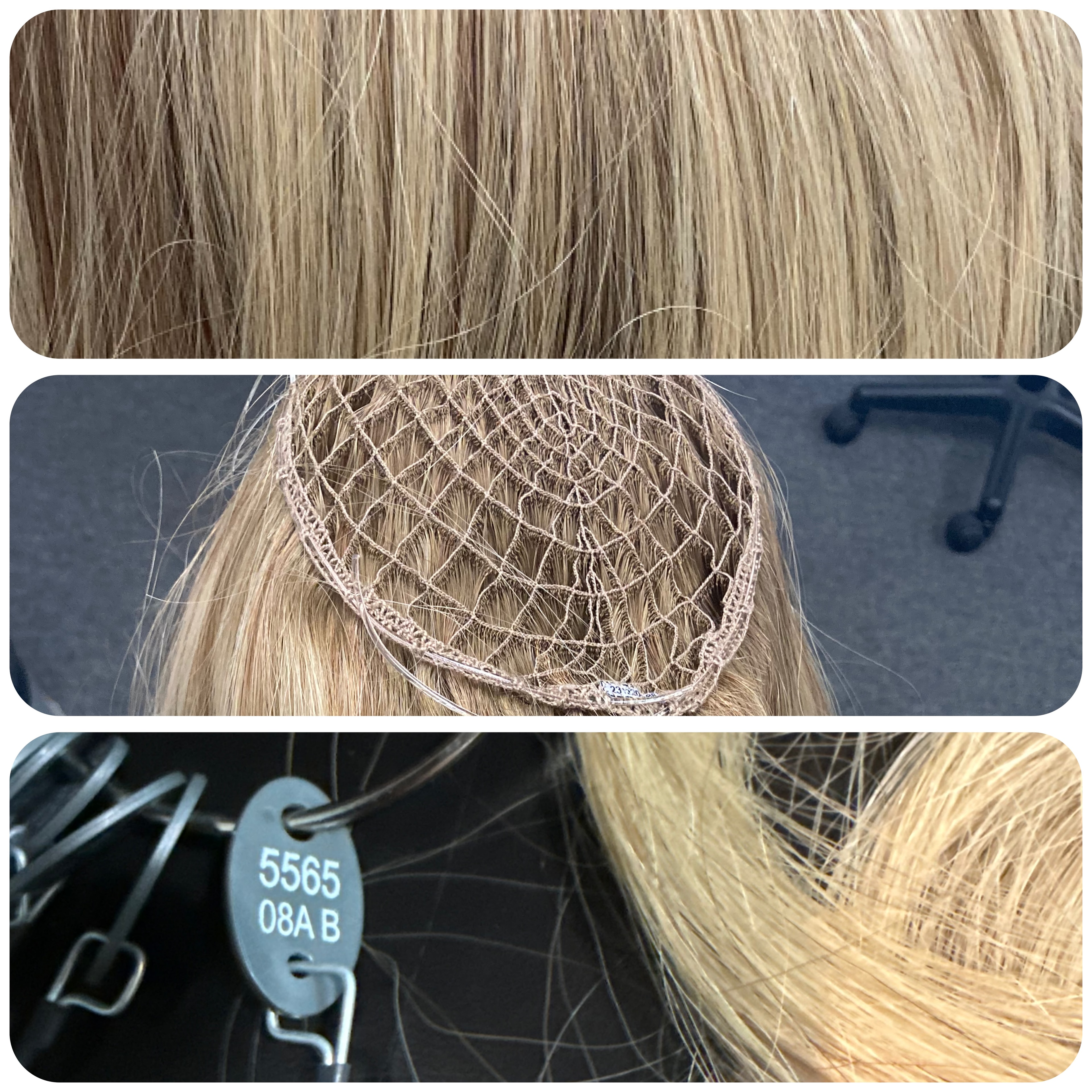 Women's Hair Loss Solutions