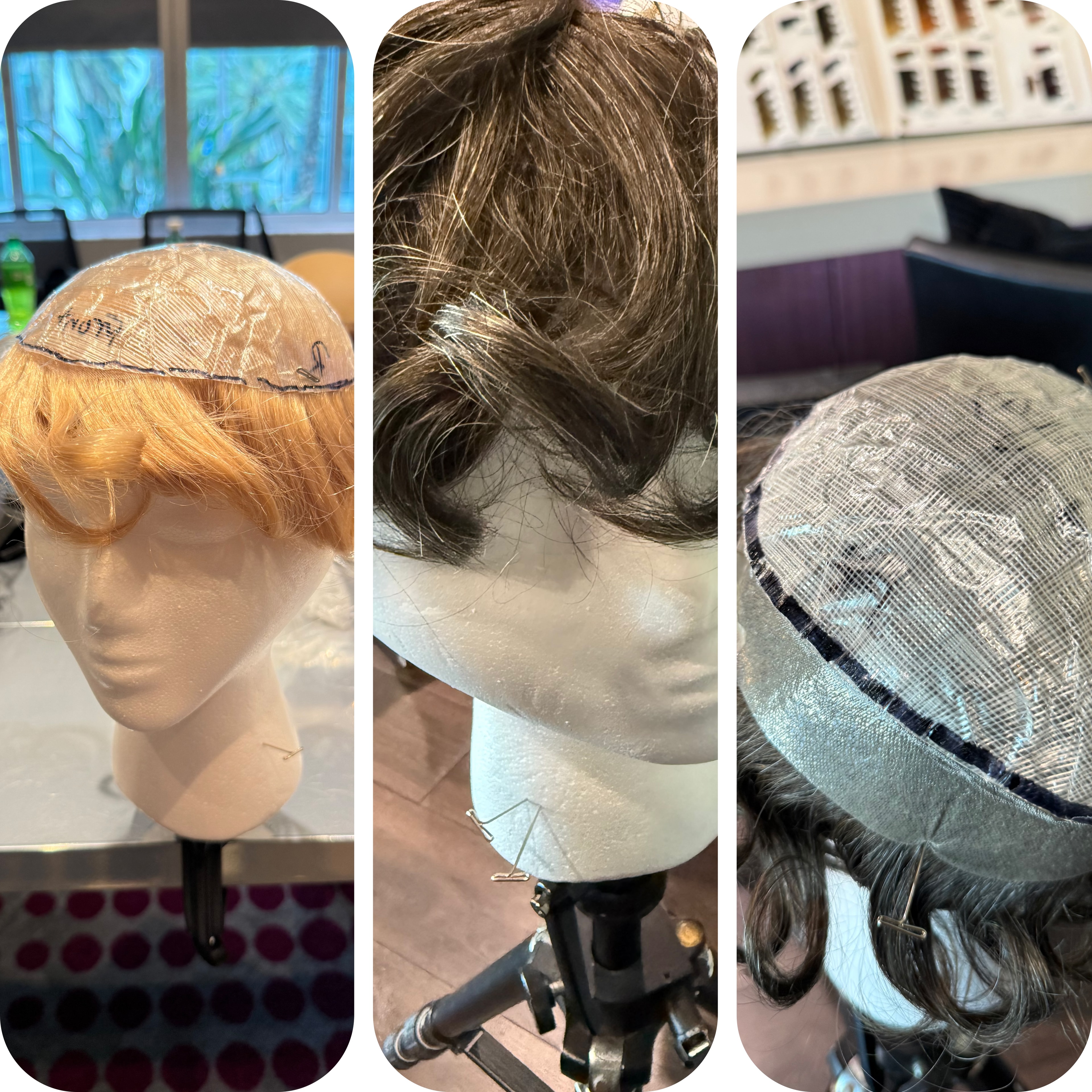 Men's Hair Loss Solutions